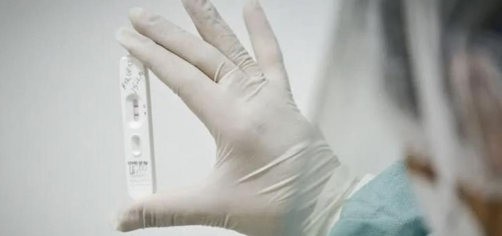 Primeiro caso da subvariante arcturus da Covid-19 é identificado em São Paulo