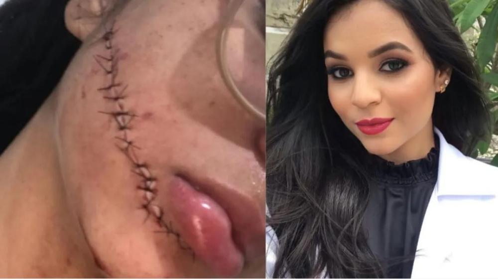 Mulher que cortou rosto de estudante em ônibus na Bahia é presa em São Paulo