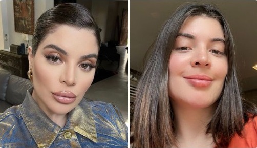 Gkay abre o jogo e revela motivo de ter retirado harmonização facial